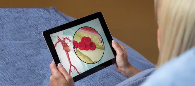 lady looking at ipad